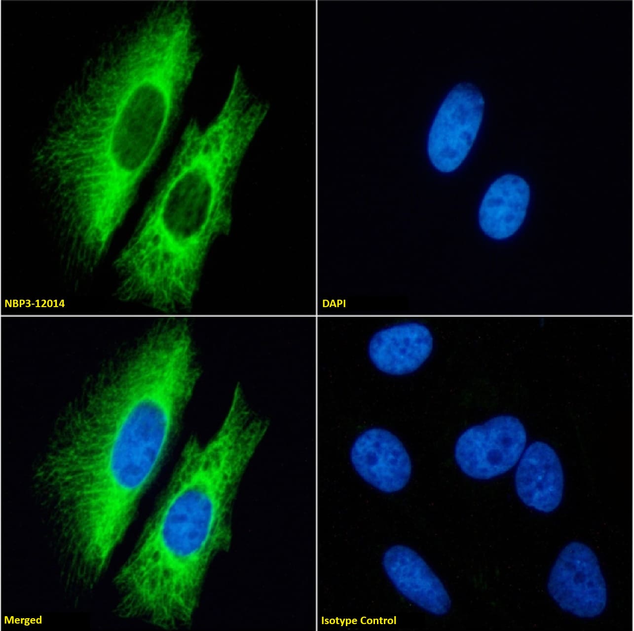 Cytokeratin 7 Antibody (OV-TL 12/30) - Chimeric - Azide and BSA Free