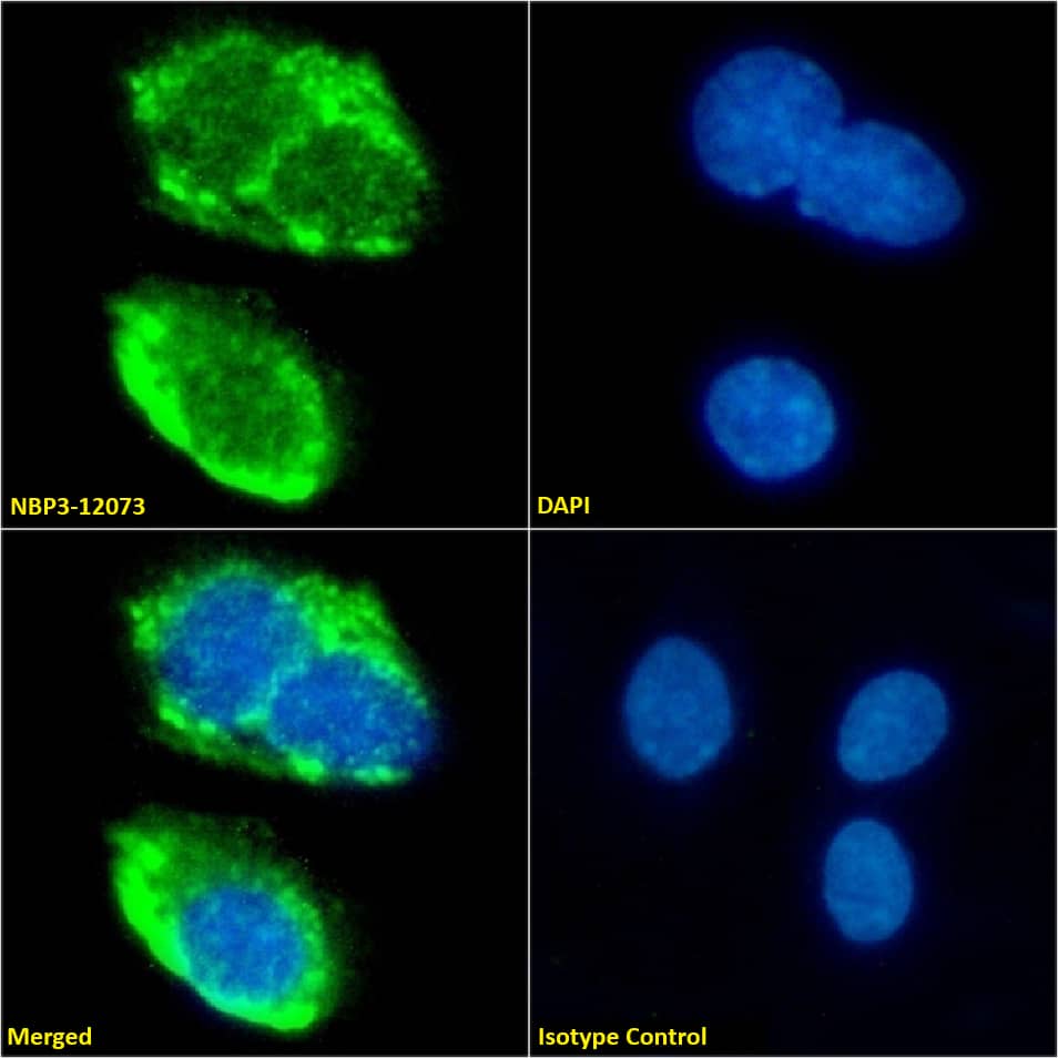 SR-BI Antibody (185-1G2 (B467)) - Chimeric - Azide and BSA Free