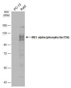 IRE1 alpha [p Ser724] Antibody