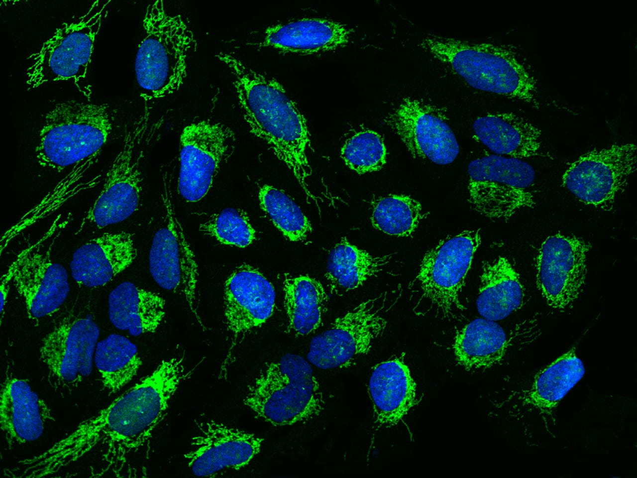 DDX49 Antibody - BSA Free