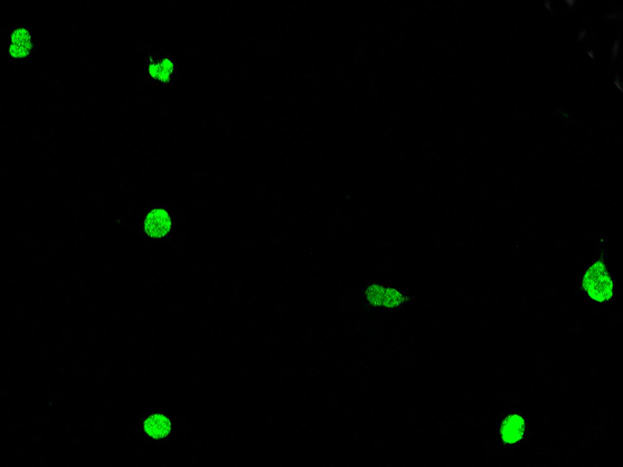 ZNF711 Antibody - BSA Free