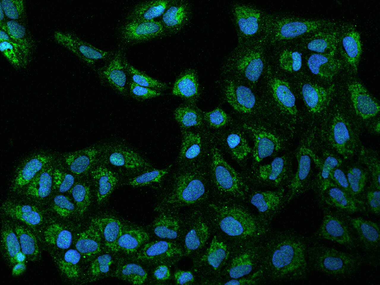 TIMM29 Antibody - BSA Free