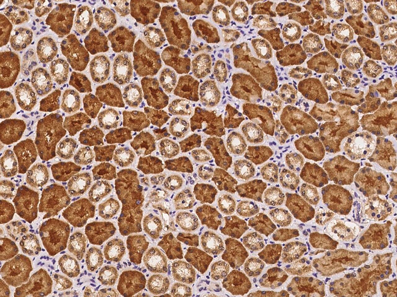 ECHDC1 Antibody - BSA Free