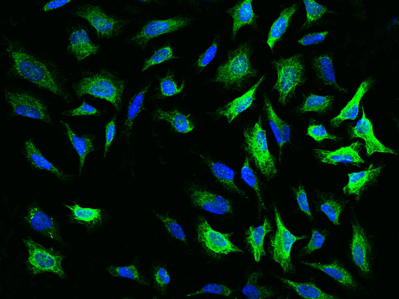 BHMT2 Antibody - BSA Free