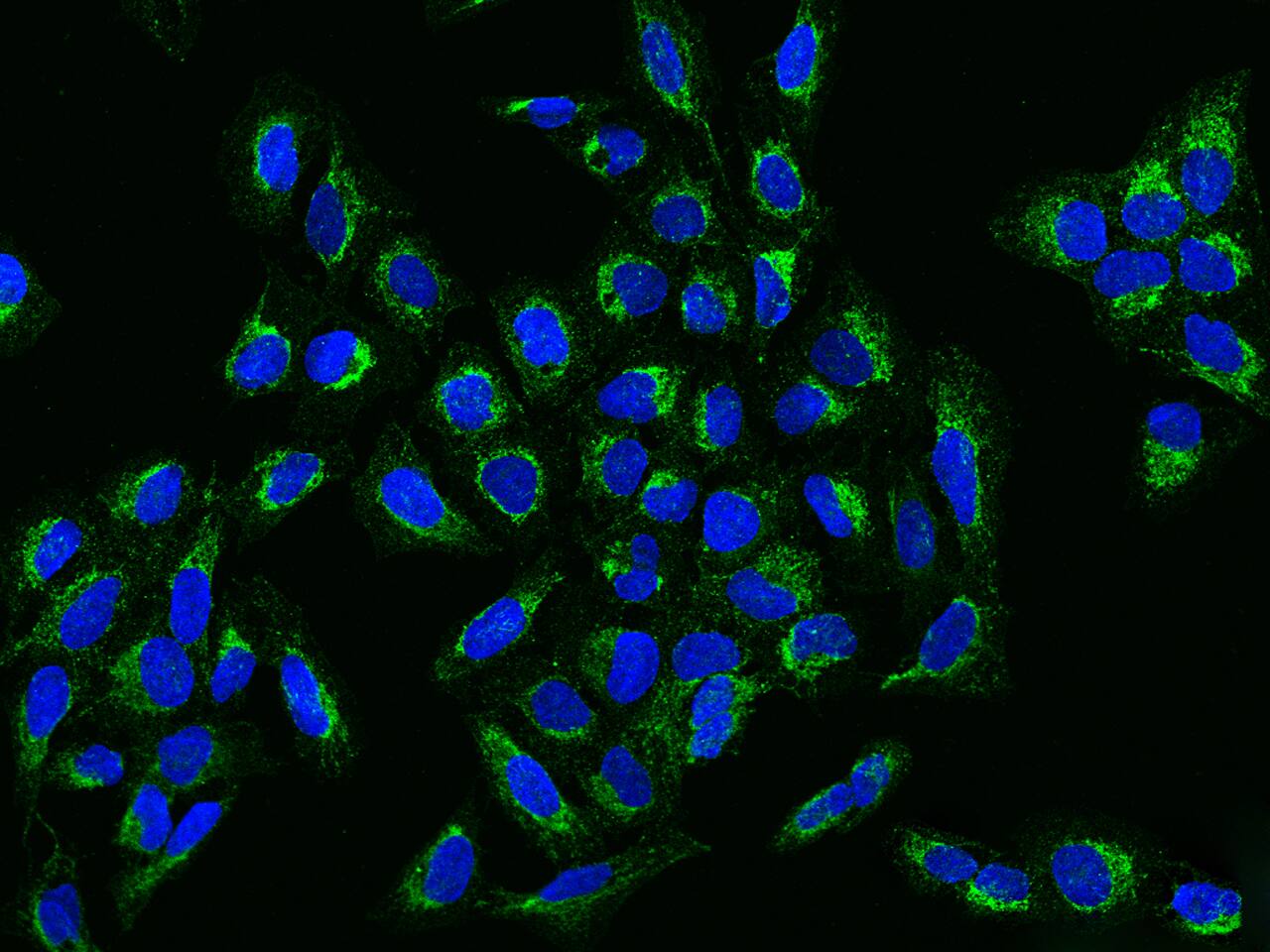Ccd1/DIXDC1 Antibody - BSA Free