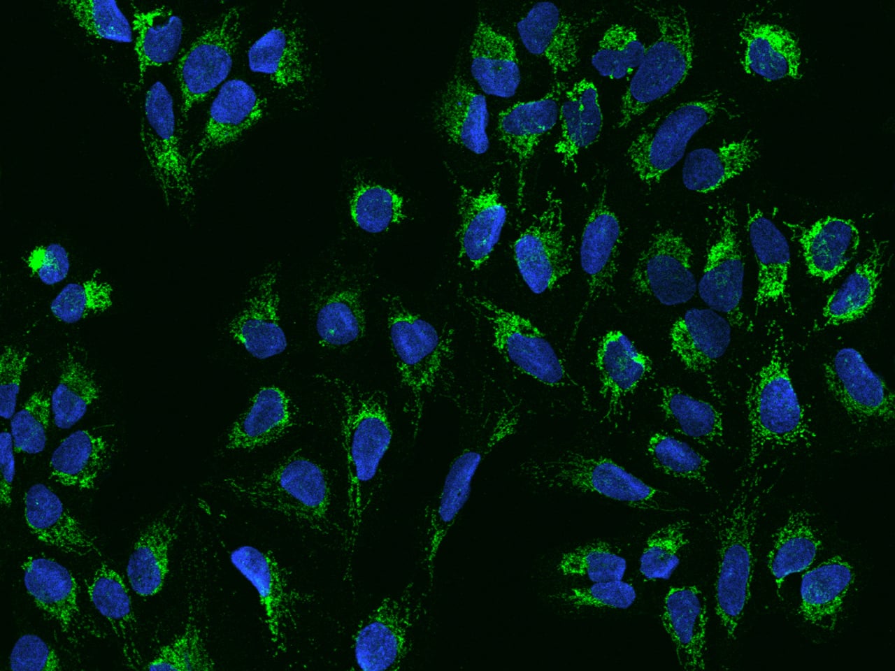 ACOT1 Antibody - BSA Free