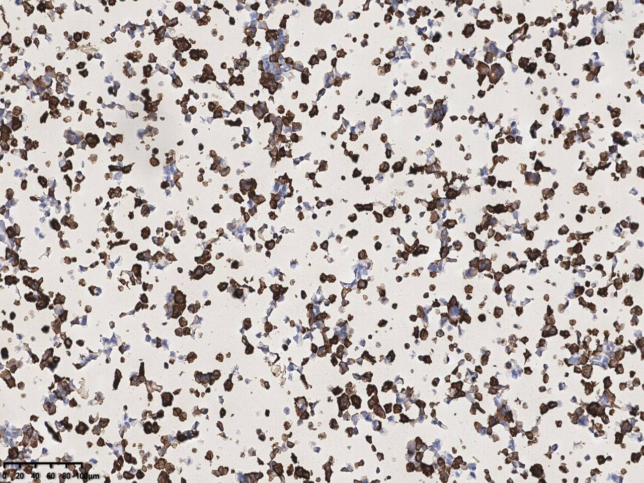 SARS-CoV-2 Nucleocapsid Antibody (004) Immunohistochemistry: SARS-CoV-2 Nucleocapsid Antibody (004) [NBP3-12734]