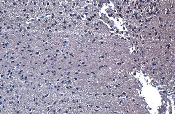 LIM1 Antibody