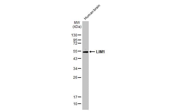 LIM1 Antibody