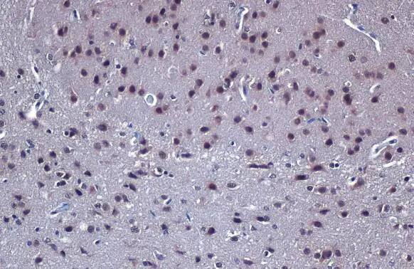 LIM1 Antibody