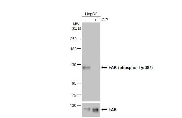 FAK [p Tyr397] Antibody