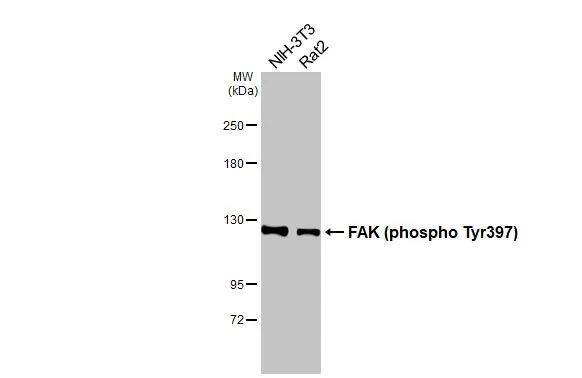 FAK [p Tyr397] Antibody