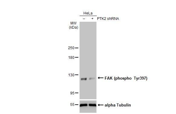 FAK [p Tyr397] Antibody