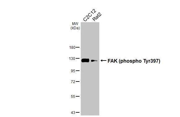 FAK [p Tyr397] Antibody