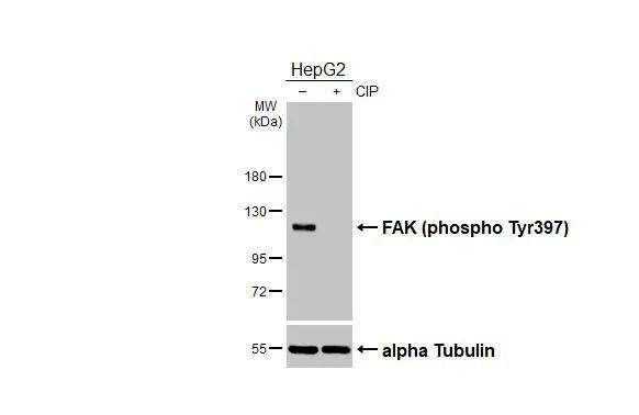 FAK [p Tyr397] Antibody