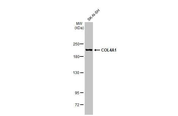 Collagen IV alpha 1 Antibody