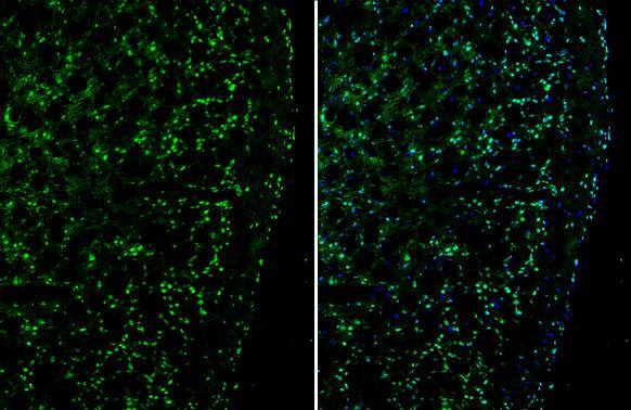 Plexin D1 Antibody - BSA Free