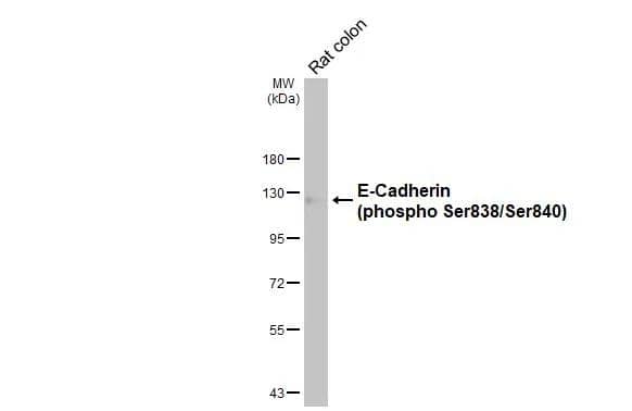 E-Cadherin [p Ser838, p Ser840] Antibody