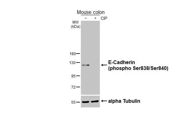 E-Cadherin [p Ser838, p Ser840] Antibody