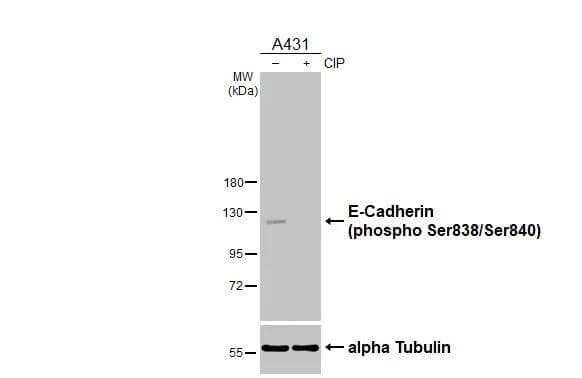 E-Cadherin [p Ser838, p Ser840] Antibody