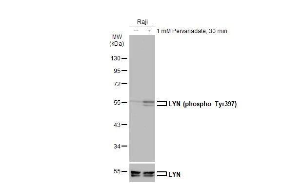 Lyn [p Tyr397] Antibody