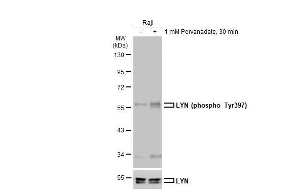 Lyn [p Tyr397] Antibody