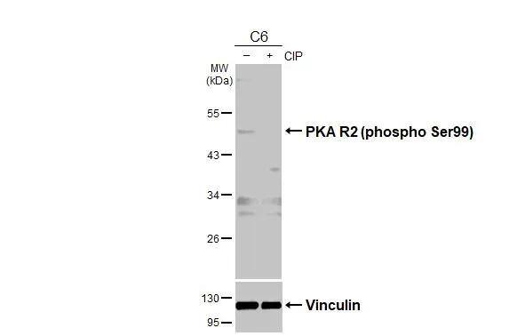 PKA R2 [p Ser96] Antibody