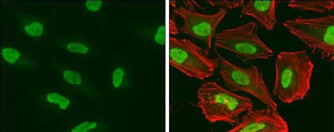 SMARCA5/SNF2H Antibody