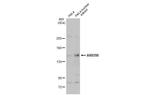 ARID5B Antibody - BSA Free