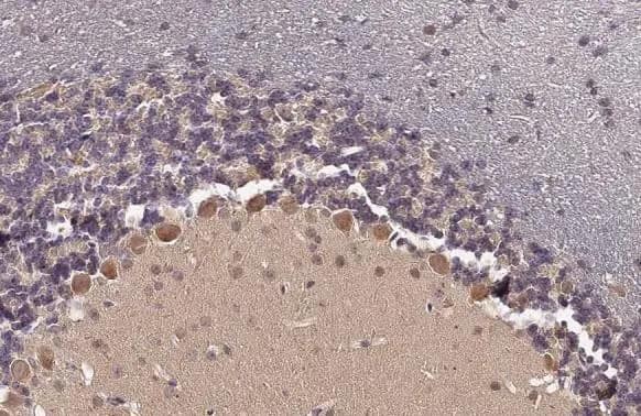 GDF-6/BMP-13 Antibody