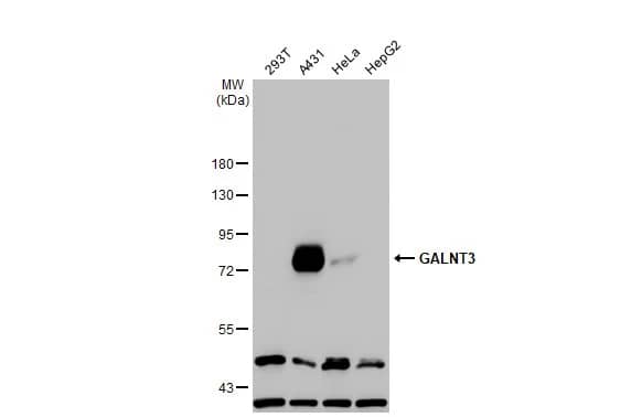 Polypeptide GalNac Transferase 3/GALNT3 Antibody