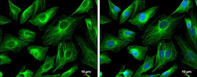 FSD1 Antibody - BSA Free