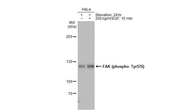 FAK [p Tyr576] Antibody