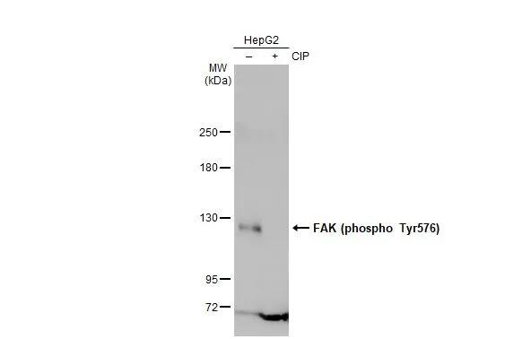 FAK [p Tyr576] Antibody