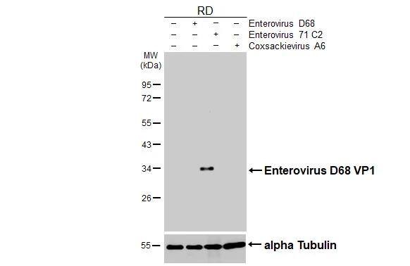 Enterovirus D68 VP1 Antibody - BSA Free