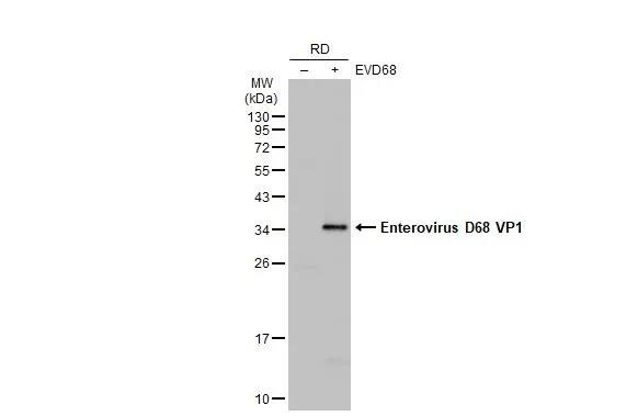Enterovirus D68 VP1 Antibody