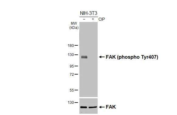 FAK [p Tyr407] Antibody