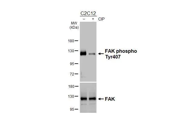 FAK [p Tyr407] Antibody