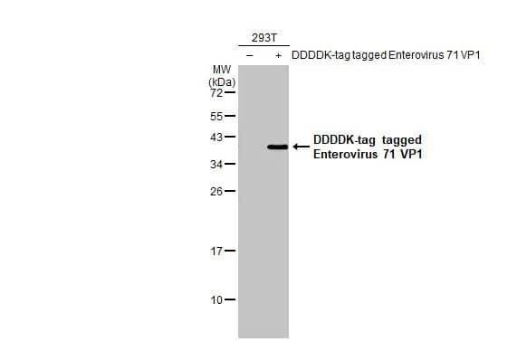 Enterovirus 71 VP1 Antibody