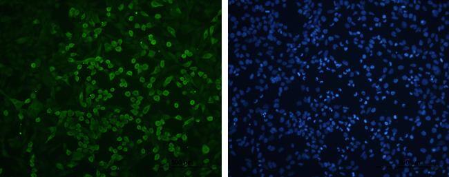 Enterovirus 71 VP1 Antibody - BSA Free