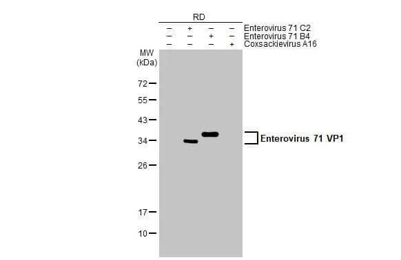 Enterovirus 71 VP1 Antibody - BSA Free