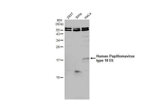 HPV18 E6 Antibody - BSA Free
