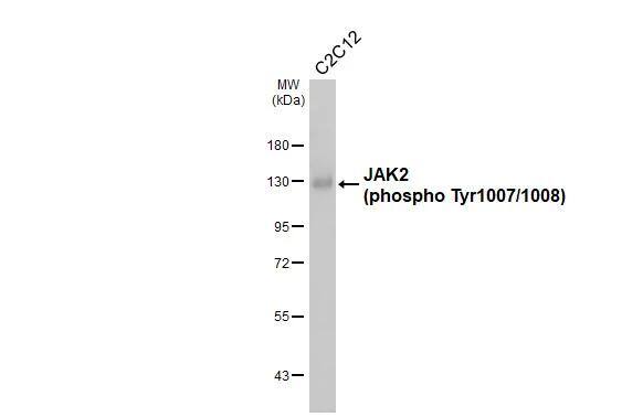 Jak2 [p Tyr1007, p Tyr1008] Antibody