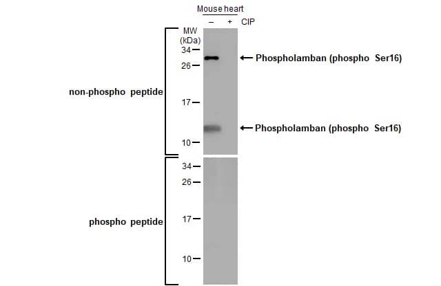 Phospholamban [p Ser16] Antibody