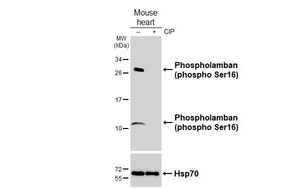 Phospholamban [p Ser16] Antibody