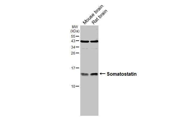 Somatostatin Antibody - BSA Free
