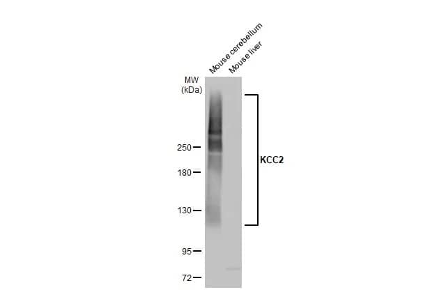 KCC2/SLC12A5 Antibody