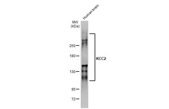 KCC2/SLC12A5 Antibody