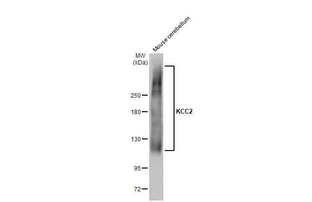 KCC2/SLC12A5 Antibody