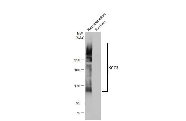 KCC2/SLC12A5 Antibody